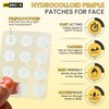 JIMBROOK Pimple Patches For Face (72 Patches) Hydrocolloid Pimple Patches