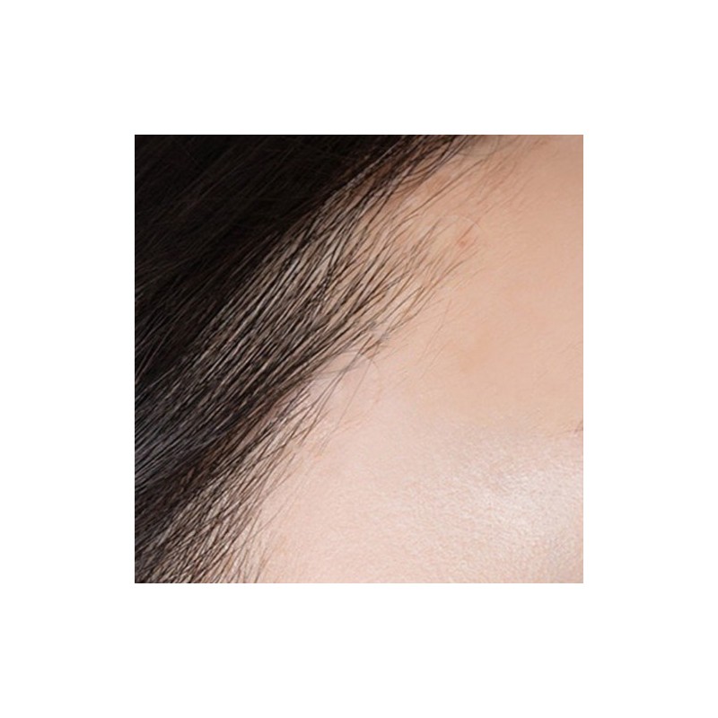 Acnes 3-Second Soothing All Clear Spot Patch Set, 8mm x