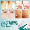Crema Removedora Mezquinos Verrugas Lunares Eficaz Sin Dolor