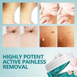 Crema Removedora Mezquinos Verrugas Lunares Eficaz Sin Dolor