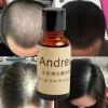 Andrea Solución Crecimiento Regenera Detiene Caída Cabello F Full