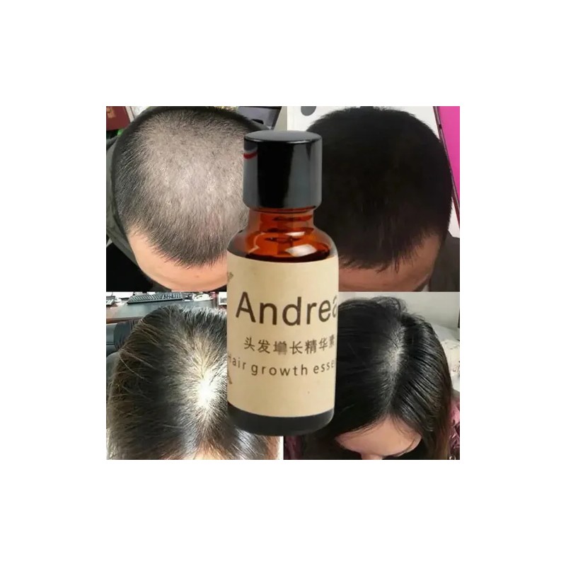 Andrea Solución Crecimiento Regenera Detiene Caída Cabello F Full