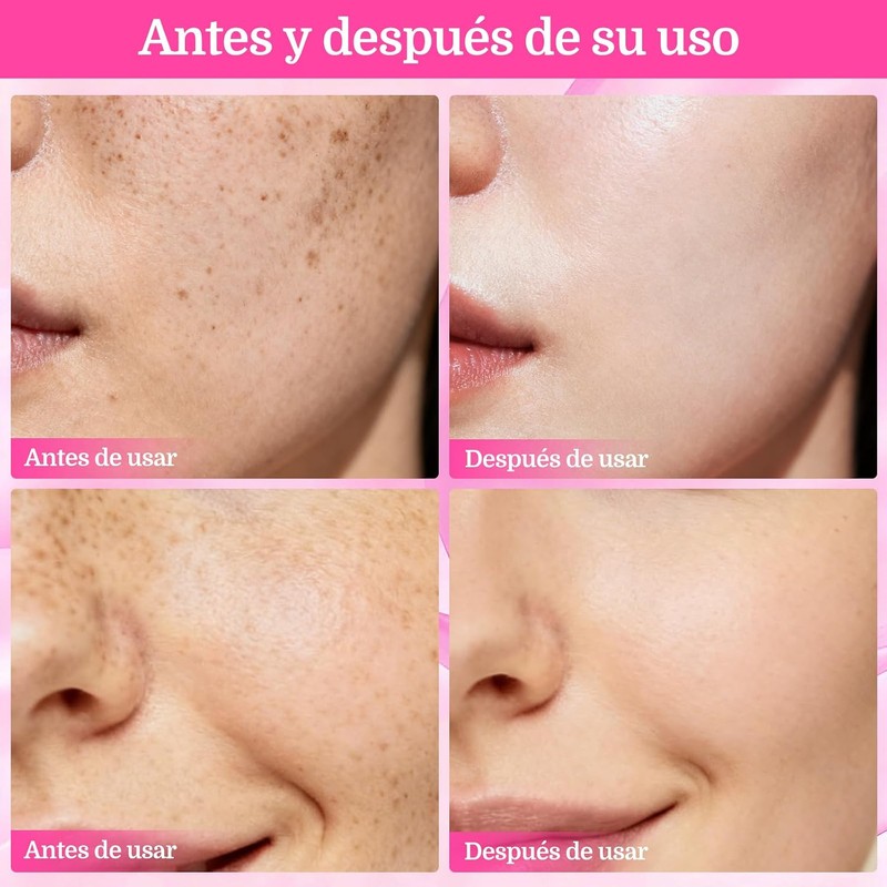 7.0 + TXA 4.0.CREAM Crema de manchas faciales