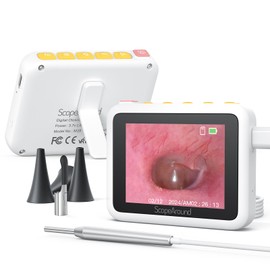 ScopeAround Otoscope with Light, 3.9mm Ultra-Thin HD Smart Visual Ear Camera, Digital Otoscope for Kids and Adults, Plug & Play Ear Wax Removal Tool Camera for Home Ear Inspection(White)