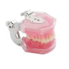 Dental Demonstration Teeth Model - Tooth Extraction Model Standard Study