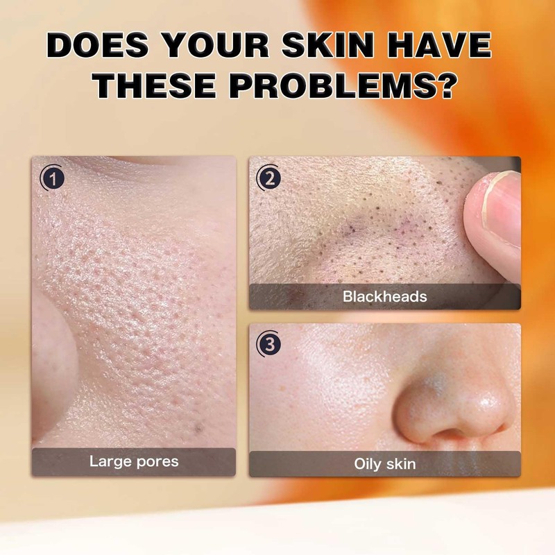 Charcoal Nose Patch, Blackhead Removal Strips, 10 Pack, Deep Cleansing