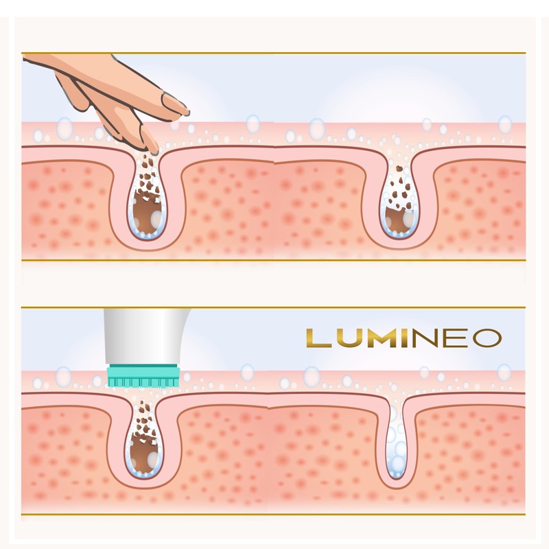 Lumineo Facial Cleansing Brush with Cleansing Gel, for Pore Exfoliating