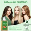 2pcs Batana Oil Shampoo,Organic Batana Oil for Hair Growth,Anti Hairs