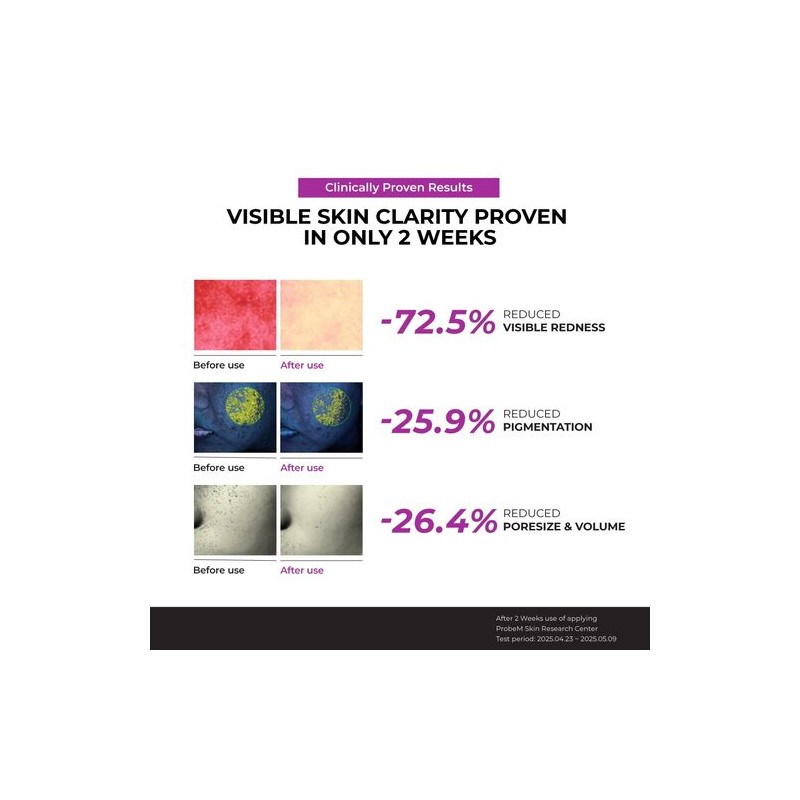 Jumiso [Jumiso]Niacinamide 10 Serum 40ml