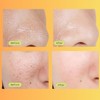 Luelle Pore Minimizer Facial Essence Serum Minimizes Appearance Reduces Skin