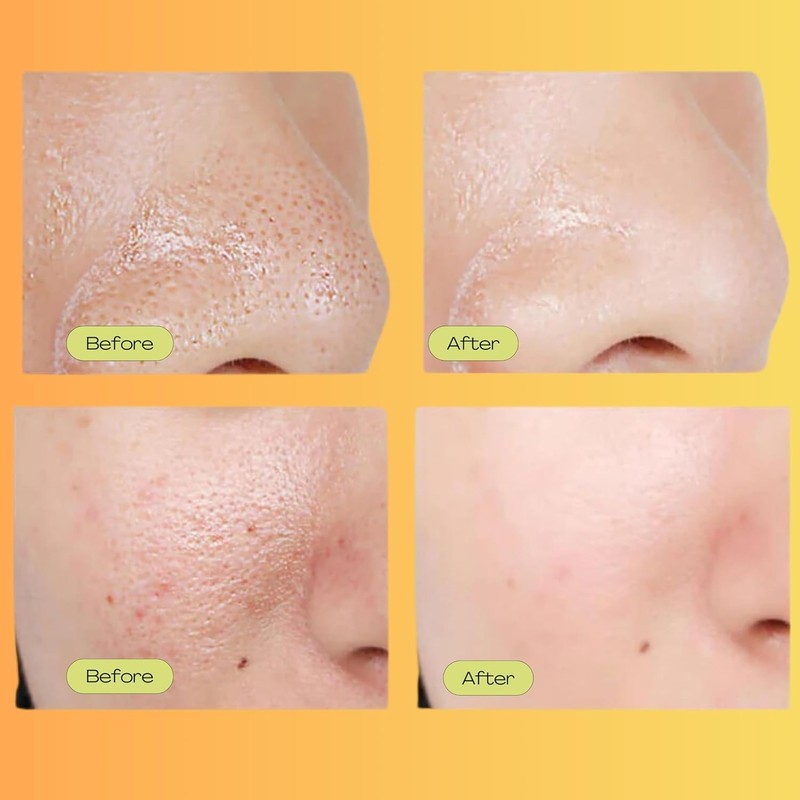 Luelle Pore Minimizer Facial Essence Serum Minimizes Appearance Reduces Skin
