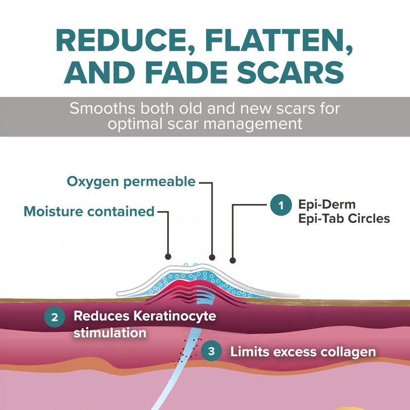 Epiderm Silicone Scar Circles – Medical Grade Silicone Scar Patches