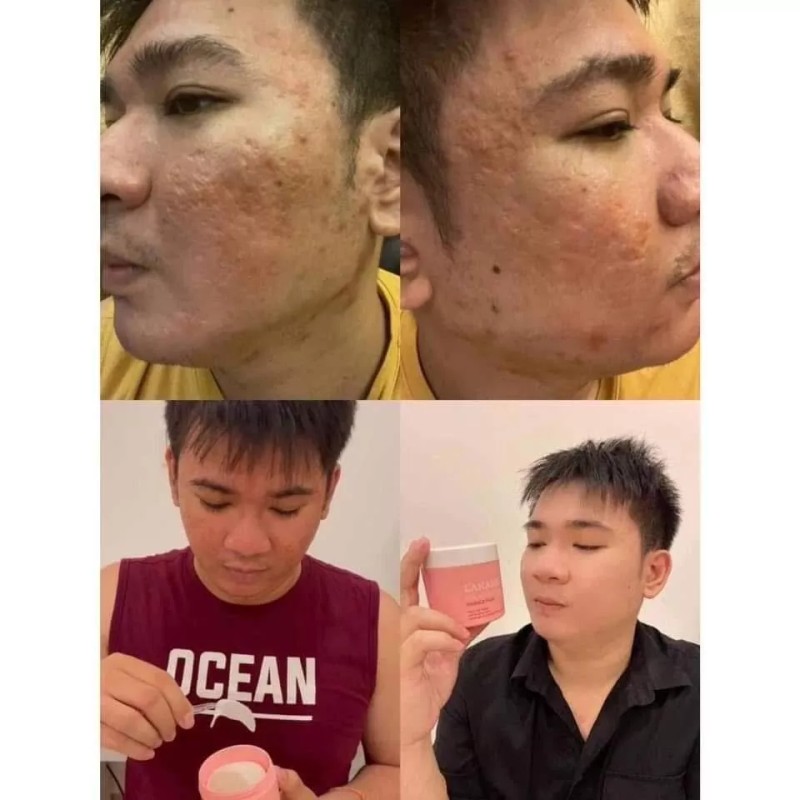 LAKAMO Pore Tightening Essence Pads សំឡីជូតមុខកូរ៉