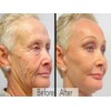 DERMA CLINICALS Retinol, Niacinamide, Vitamin C, Hyaluronic Acid, AntiAging Wrinkle