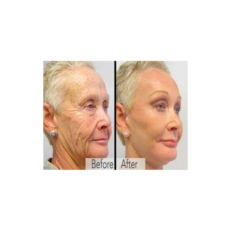 DERMA CLINICALS Retinol, Niacinamide, Vitamin C, Hyaluronic Acid, AntiAging Wrinkle