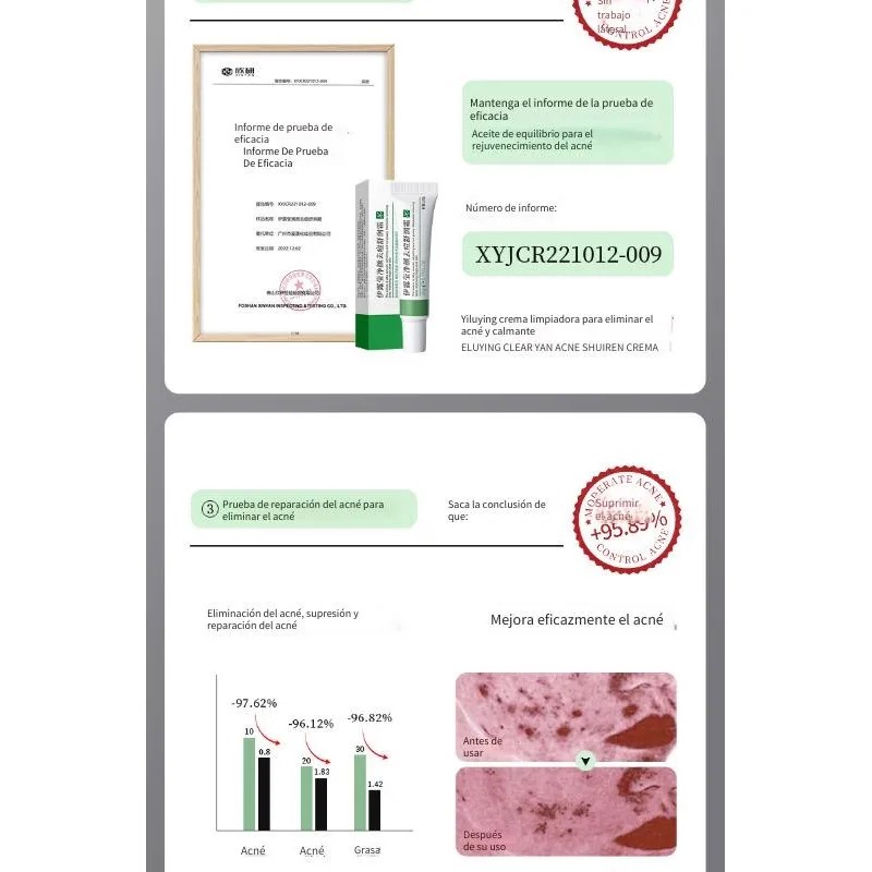 Crema Facial Antiacné Piel Grasa 20g Ebug Todo Tipo Noche