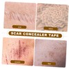 Ipetboom Scar Cover up Sticker Light Weight Temporary Skin Cover