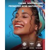 600 Piezas Lindos Parches para,parches hidrocoloides para acné,pimple patch star,Pimple