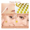 280pzs Mascarillas Estrella Acne