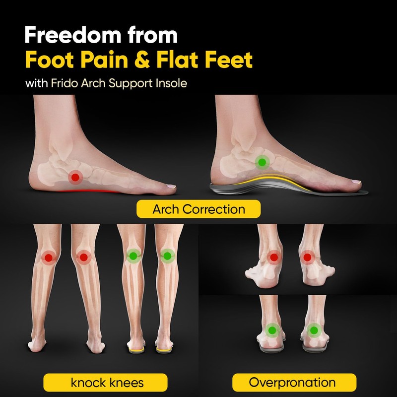 Frido Arch Support Rigid Insole for Flat Feet, Relieves Feet