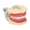 Periodontal Disease Teeth Resin Model Dental Demonstration Teeth Model for