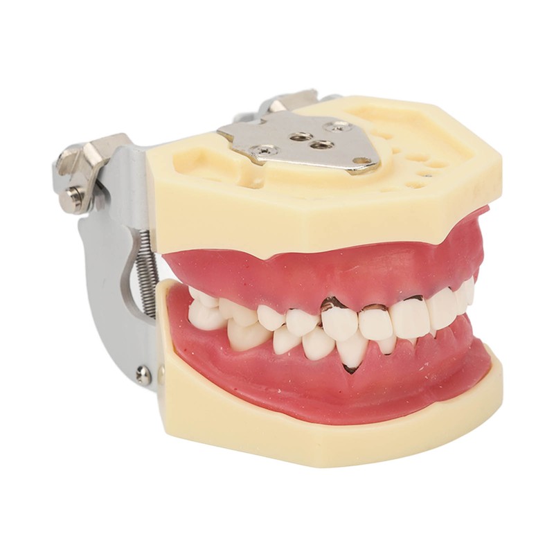Periodontal Disease Teeth Resin Model Dental Demonstration Teeth Model for