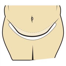 Tummy Liners Set of 3, 2XL