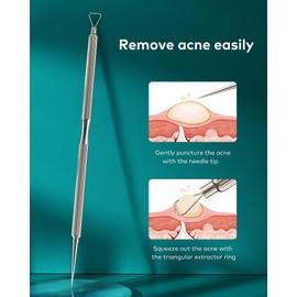 MR.GREEN Herramienta profesional para eliminar puntos negros, kit de herramientas para espinillas, kit de extracción 2 en 1, herramientas de piel para cara, espinillas y espinillas