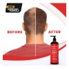 Dht Blocker Champú Anti-pérdida De Cabello Con Biotina