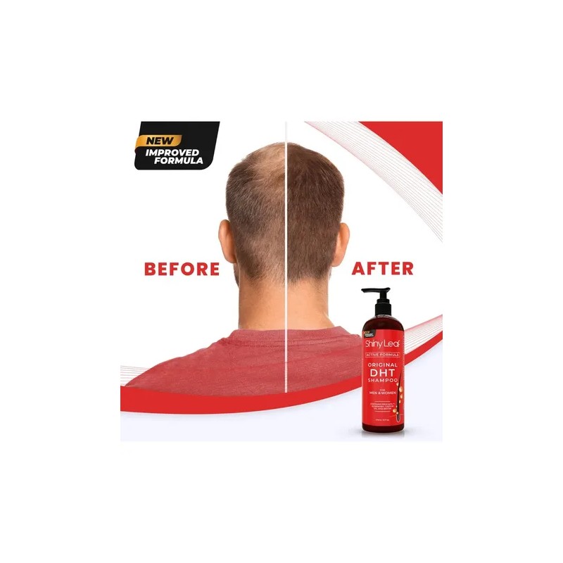 Dht Blocker Champú Anti-pérdida De Cabello Con Biotina