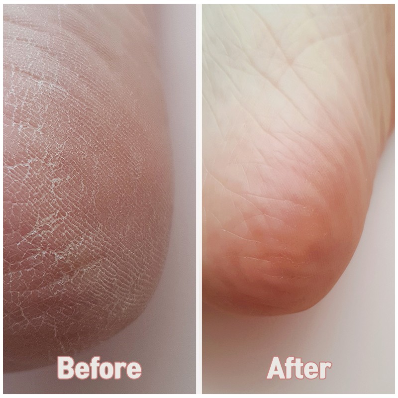 Mad for Cos Silky Coconut Oil Foot Mask 10 sheets