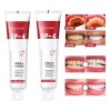 Pasta De Dientes Sp-4 Con Probióticos Blanqueadores