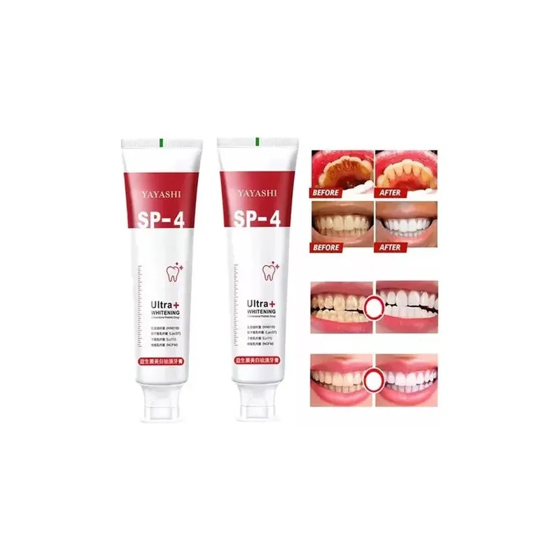 Pasta De Dientes Sp-4 Con Probióticos Blanqueadores