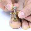 Ingrown Toenail Corrector Tape Band Set Ingrown Toenail RX-21 /