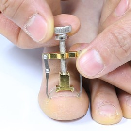 Ingrown Toenail Corrector Tape Band Set Ingrown Toenail RX-21 / 내성발톱 교정기 테이프 밴드 세트 내향성발톱 RX-21