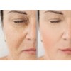 Vitality Precision Skin Phloretin C Serum