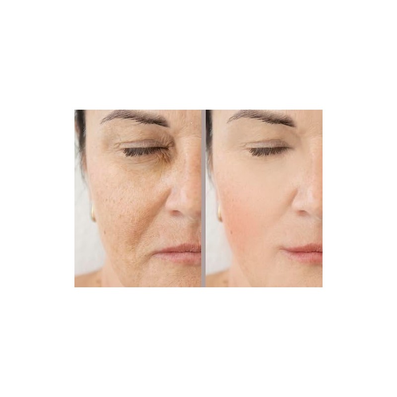 Vitality Precision Skin Phloretin C Serum