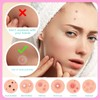 EFLY Pimple Patches for Face, Acne Patches Hydrocolloid with Tea