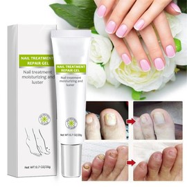 Nail Repair Gel & Cream - Renews Yellow, Cracked, Damaged & Split Nails & Toenails, Beautiful Results