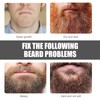 Beard Growth Kit with Rollers Beard Growth Agent Men Black