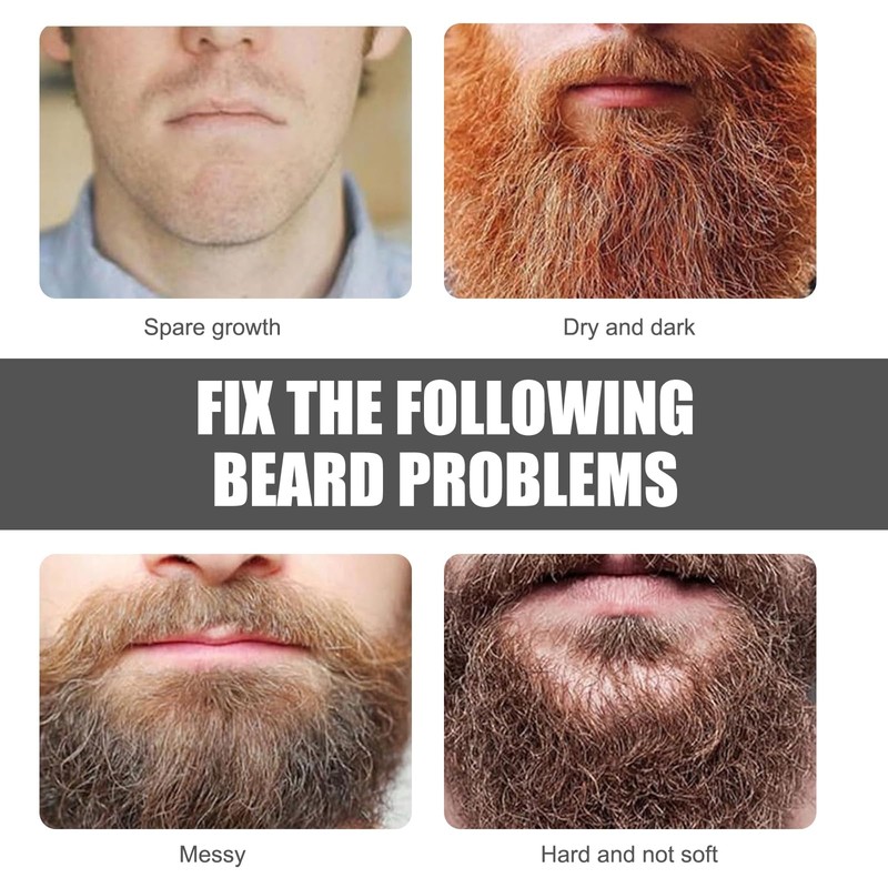 Beard Growth Kit with Rollers Beard Growth Agent Men Black