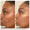 Urban Skin Rx 3-in-1 Even Tone Cleansing Bar - 2.0oz