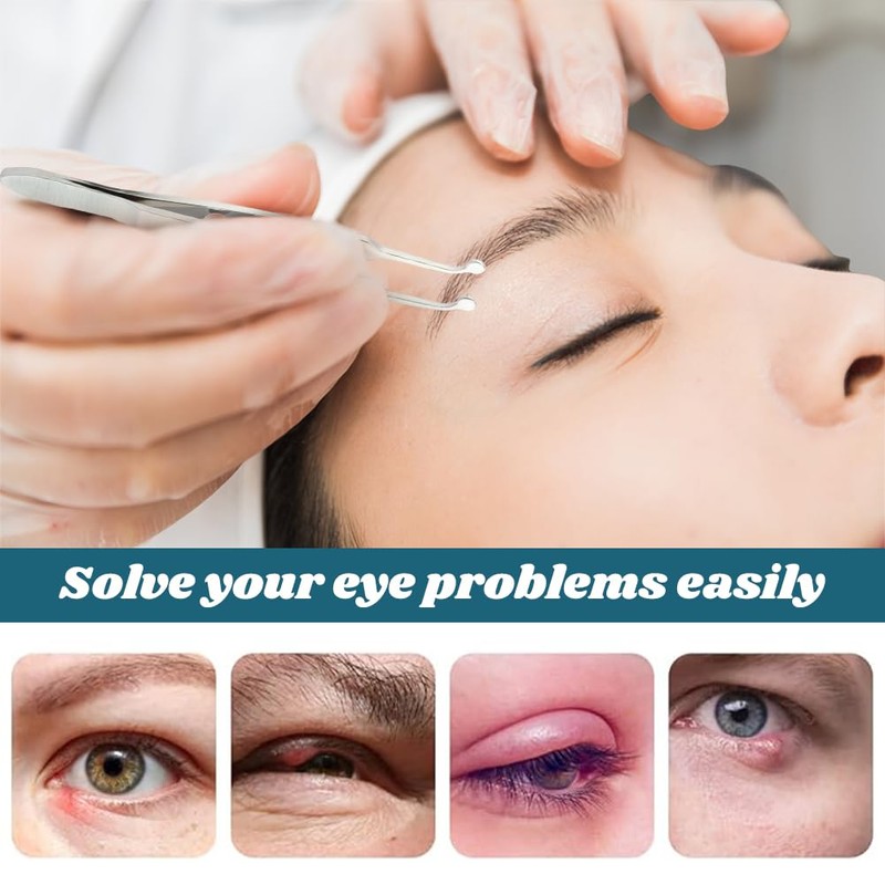 JIANWEI Meibomian Gland Expressor, Eyelid Gland Blockage Unblocking Physiotherapy Tools,