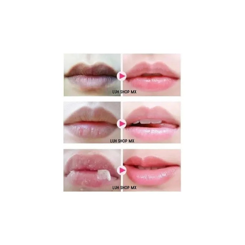 Mix 10 Parches Colágeno Ojos + Labios. Mascarilla Hidrogel