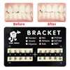20 Piezas de Brackets Dentales para Ortodoncia Sistema de Ranura