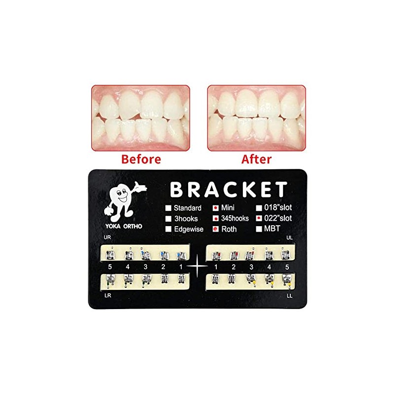 20 Piezas de Brackets Dentales para Ortodoncia Sistema de Ranura