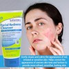 Treedurma 트리더마 페이셜 레드니스 클렌저 페이스 워시 붉고 자극받은 6.2온스
