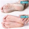 Cracked Foot Cream Roll-On Moisturizer, 1.76floz