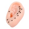 Ear Pimple Popping Toy with Tweezers Funny Blackhead Squeeze Out