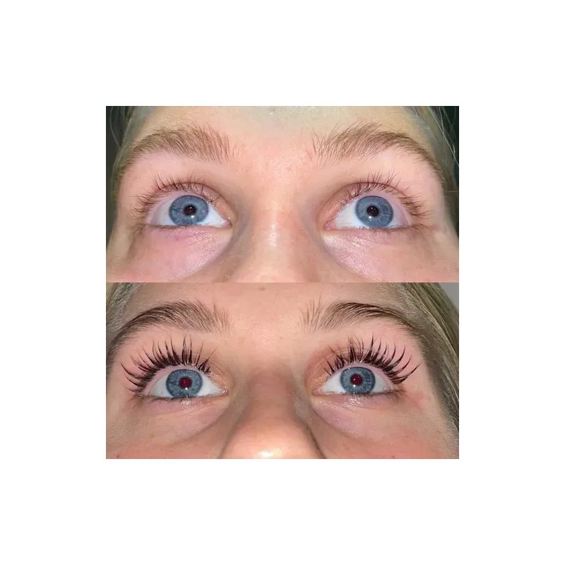 Versox Original Pestañas Cejas Estimulador Efectivo Serum